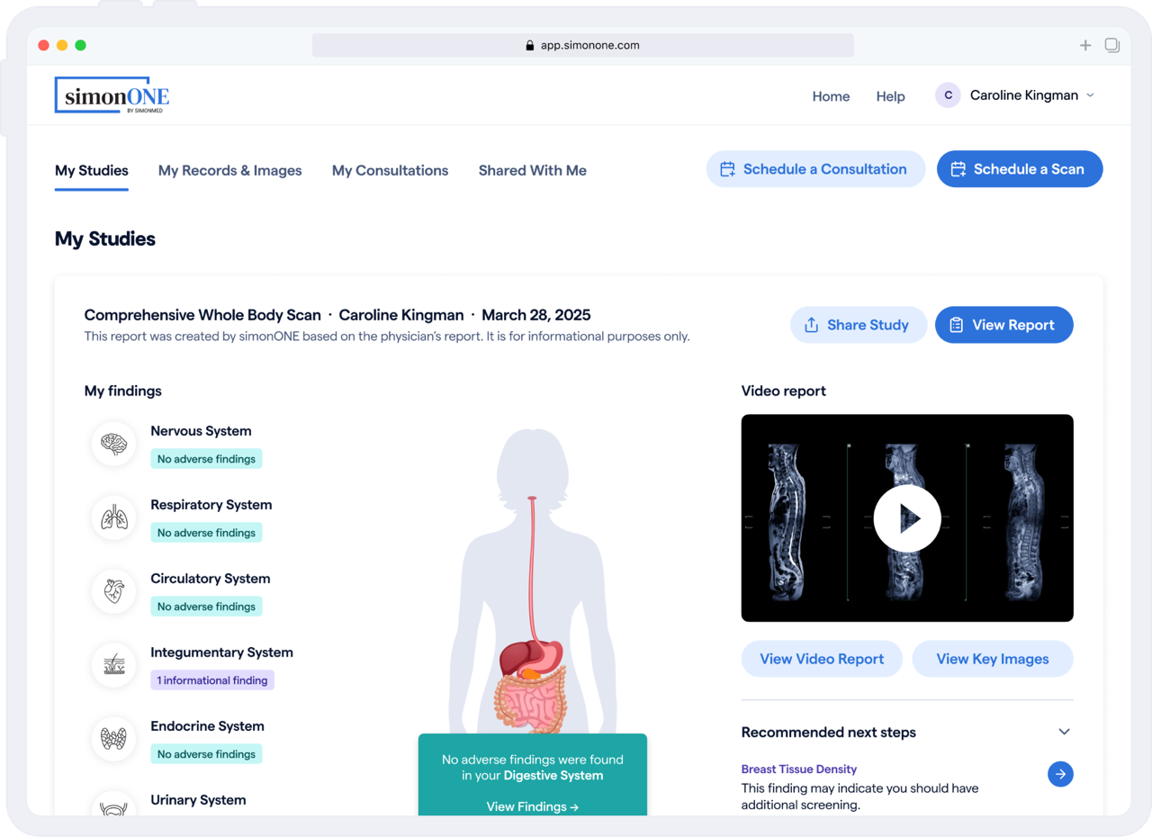 Interactive simonONE Report